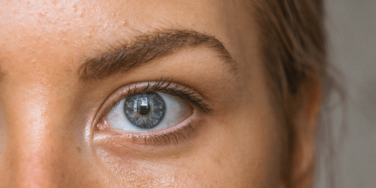 Brow Lift: Transformative Aesthetics at Aesthetic MDR