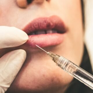 Evolve Medical on Celebrities, Botox, Fillers, and Laser Care