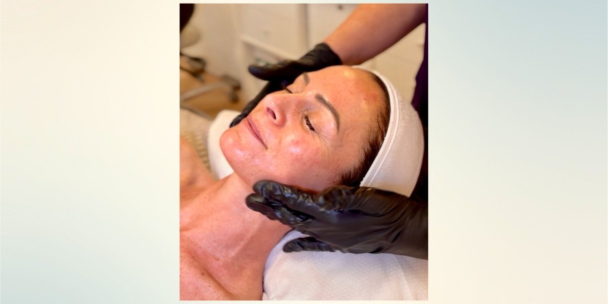 What Is Baby Botox? When It Works and When It Doesn't