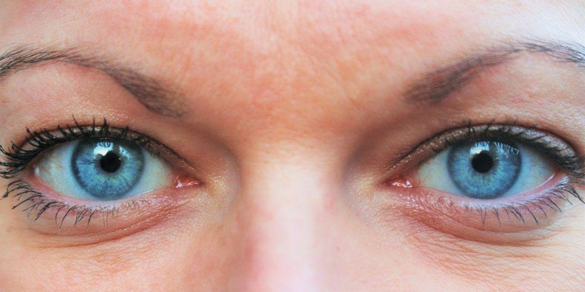 How to Reduce Eye Bags and Dark Circles With Proper Care
